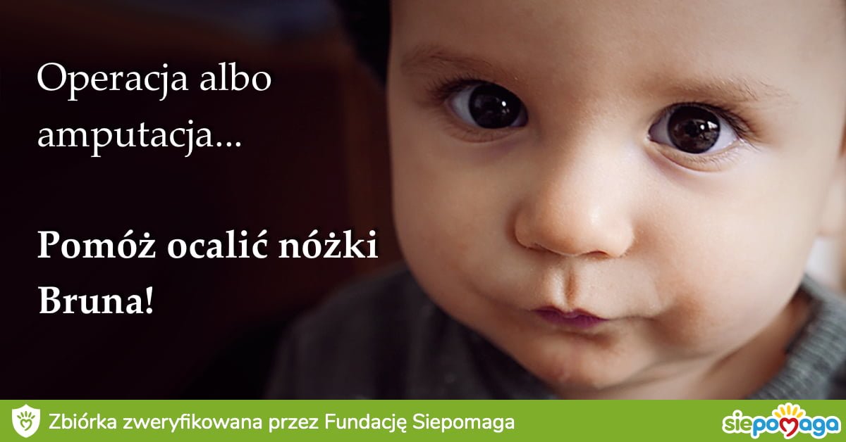 Photo of Bez operacji Bruno straci nóżki… Nie pozwólmy na to!