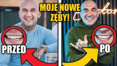 Photo of Sobota – Hollywood Smile (Licówki i korony w Turcji)